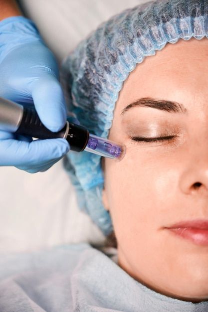 Mesotherapy treatment